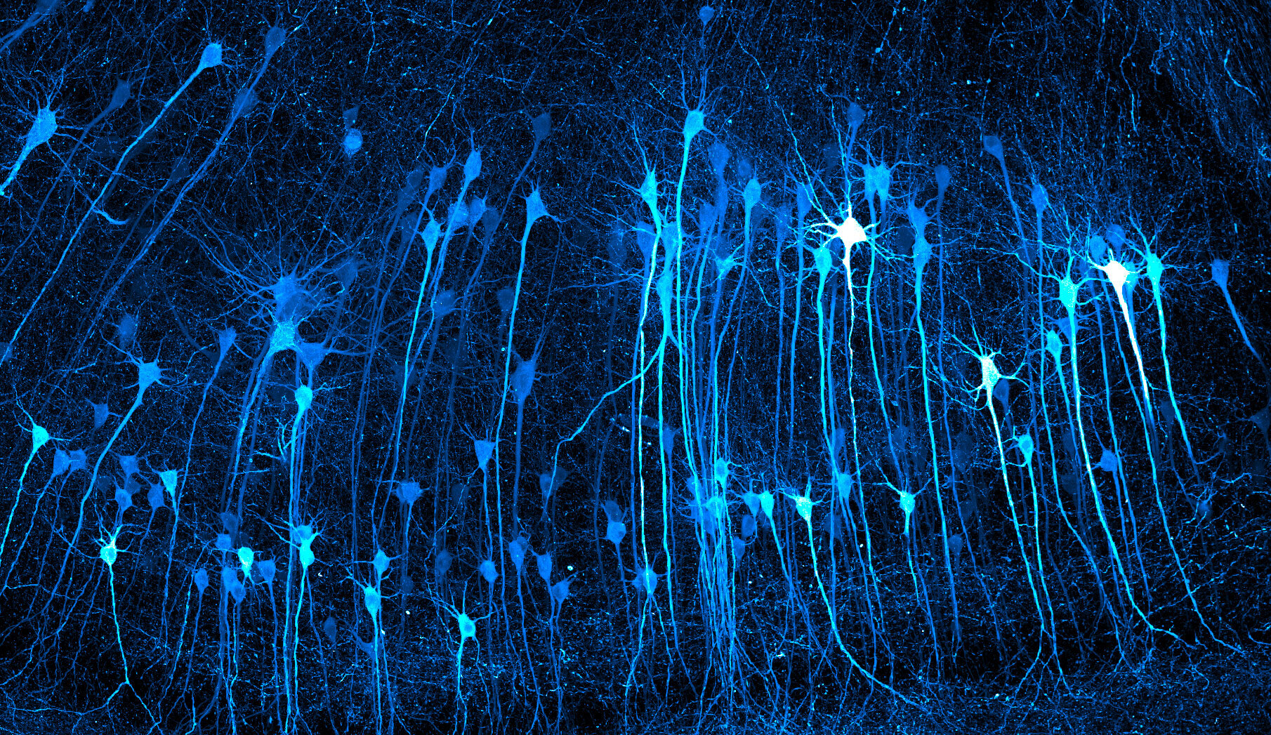 mouse_brain