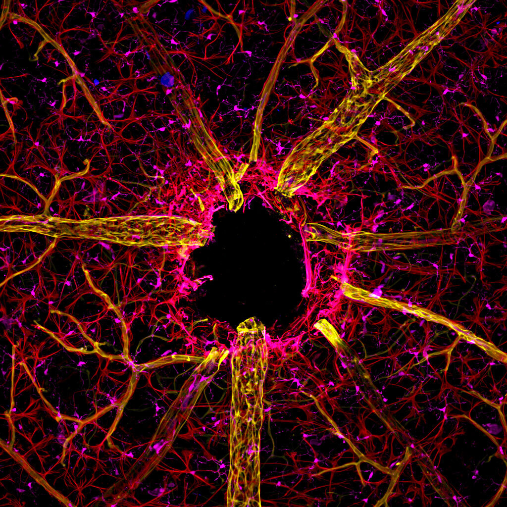 mouse_optic_nerve